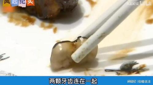 媒体爆料假牙视频,媒体曝光惊人视频曝光全过程